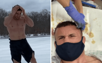 UFC Fighter Jumps Into the Frozen Lake and Ends up in Hospital With Bloody Head