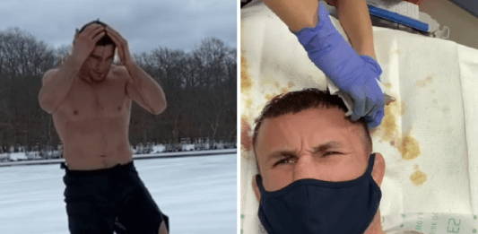 UFC Fighter Jumps Into the Frozen Lake and Ends up in Hospital With Bloody Head