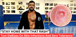 “Train With A Rash And You’re Selfish”: Tom DeBlass On Skin Infections and Gym Bans
