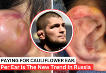 Russian Men Paying For Fake Cauliflower Ear Procedures To Look Tough Russian Men Paying For Fake Cauliflower Ear Procedures To Look Tough