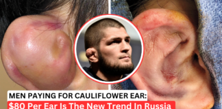 Russian Men Paying For Fake Cauliflower Ear Procedures To Look Tough
