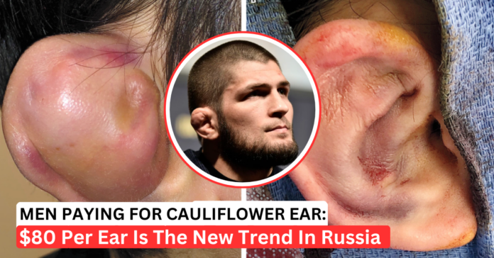 russian-men-paying-for-fake-cauliflower-ear Russian Men Paying For Fake Cauliflower Ear Procedures To Look Tough